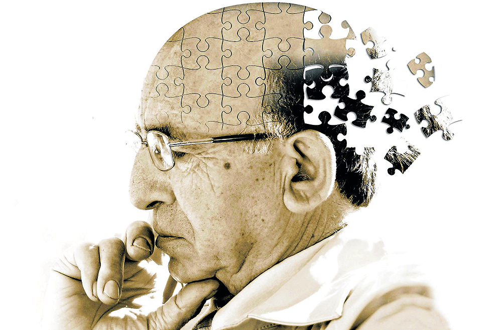 Alzheimer hastalığı nasıl başlar?